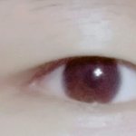[댓글부탁해] 사진0 쌍수 할지말지 좀 봐줘