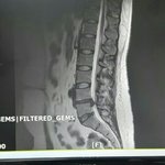 디스크시술을 받고 의사한테  사기를 당했습니다.도와주세요.