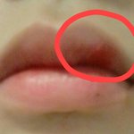 [댓글부탁해] <b>입술</b>뜯어진거 어떻게함?