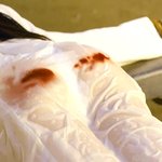 나 짝 있는데 너무 세게 했더니 <b>피나</b>...