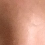 [조언부탁해] 나<b>짝눈</b>너무심한데 쌍수할까