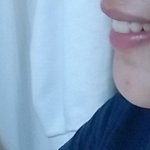 ㅅㅂ나 <b>교정</b>하고 주걱턱 됨