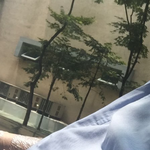 추가)사진과 내용추가입니다.  사마귀 제거하러 간 동생이 의식불명이...