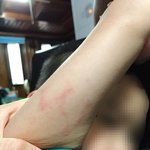 [댓글부탁해] <b>아동</b>학대를 당했습니다ㅠㅠ