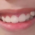 [댓글부탁해] 얘드라 나 교정해야 될까 ㅜㅜ...?