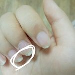 이거 <b>손톱</b> 왜이러는지 알아?