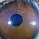 [댓글부탁해] 아이폰으로 <b>홍채</b>사진찍는법좀