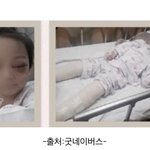 5살아이 내<b>연남</b>의 폭행..실명에 간은 너덜거리고 ..아고라 서명인데...