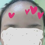 나 <b>이마</b> 심각하게 드넓음ㅋㅋㅋㅋㅋㅋㅋㅋㅋ