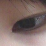 [조언부탁해] 이거 여드름 어떻게 짜냐.. 제발.......