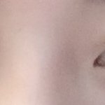 <b>쌍수</b>고민중이에요 봐주세용!ㅜ