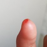 [드루와] 나 귀에서 <b>피나</b>