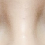 쌍수 <b>전후</b>
