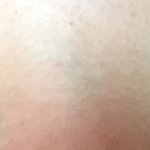 [댓글부탁해] <b>속</b><b>쌍</b>인데 쌍수하면 괜찮을 거 같음?