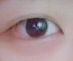 [댓글부탁해] 쌍커<b>풀</b> 있는데 쌍수 가능?