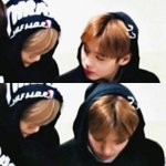 [워너원] 형 많이<b>아파</b>??