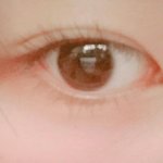 <b>눈밑</b>에도다래끼나냐?