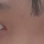 쌍수 해야겠지ㅠㅠ?