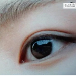 [댓글부탁해] 쌍꺼풀 <b>재수술</b>할건데