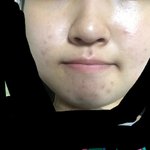 [조언부탁해] 내피부좀 도와줘라ㅈㅂㅈㅂ ㅜㅜㅠㅜㅜ