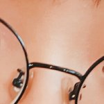 나 쌍수해도 될까??