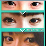 ㅇㅑ 이 쌍수 진짜 <b>오바</b>지않냐. .
