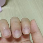 [조언부탁해] 내 <b>손톱</b>상태 ㄹㅇ개심각해...
