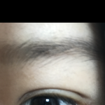 [조언부탁해] 약혐)애들아! 쌍수 후기(?)로 돌아왔어!