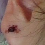 [조언부탁해] <b>약약</b><b>약약</b>혐)귀 뚫었는데 피 ㅈㄴ나