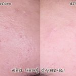 <b>모공</b> 큰분들이라면~
