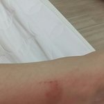 모기야 <b>시밤</b> 넌 태어나지말았어야됨