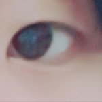 쌍수하고싶긴한데 <b>내</b> <b>눈</b> 눈지방 많은편이야??