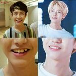 [NCT] 인준이 <b>치아</b>교정 했던데