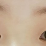 <b>쌍</b>액한거랑 안한거랑 어떤게 더 낫니ㅜㅜ