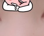 [꼭조언부탁] 고1이 <b>쌍수</b>한게 죄인가요?