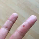존ㄴ나 아프다 씨빨 ㅠㅠㅠ