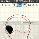 [꼭봐주세요] 평생 괴롭네