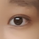 [드루와] 쌍수8개월후기(질문받아!)