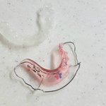 [댓글부탁해] 교정유지<b>장치</b> 장단점알려줌 ㅇㅇ