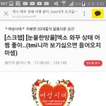 [댓글부탁해] <b>여시</b> 엑소 극혐해하는거 실화?