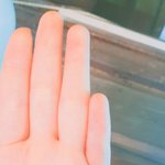 나처럼 새끼 손가락 짧은 애있어?