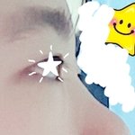 [댓글부탁해] 나 코<b>필러</b> 맞아볼까?