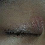 나 눈꺼풀이 이상해ㅜㅜㅠㅠ(<b>사진약</b>혐