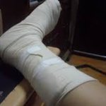 [꼭봐주세요] <b>물리</b>치료사 원래 싸가지 없나요?