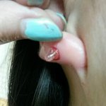 ㅁㅊ얘들아 귀 뚫은지 한<b>달째</b>인데 피 고름 개많이나와ㅜ(혐주의)