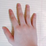 [조언부탁해] <b>손톱</b> 안 물어뜯으려면 어떻게 해야 돼?