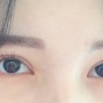 [댓글부탁해] 나 쌍수했는데 내 눈 좀 봐줘ㅠㅠㅠ