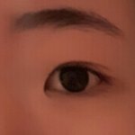 <b>쌍수</b> 앞트임 때문에 그러는데