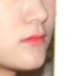 [댓글부탁해] <b>양악</b>할까?ㅜㅜ