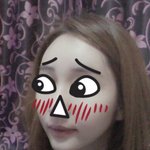 [댓글부탁해] <b>사각</b>턱성형 하고 왔음!